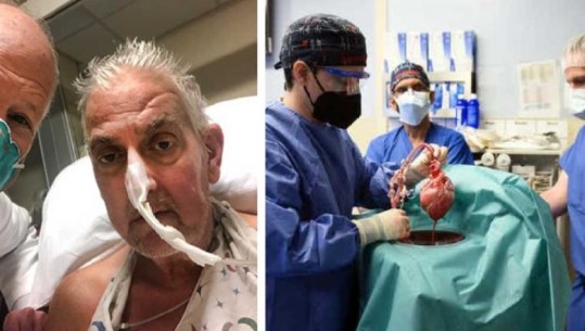 U bë njeriu i parë që transplantoi zemër derri, kush është 57-vjeçari që tentoi të kryente një krim ‘pasioni’ për dashurinë shumë vite më parë