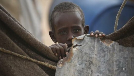 Një fëmijë vdes nga uria çdo 30 sekonda në Afrikë