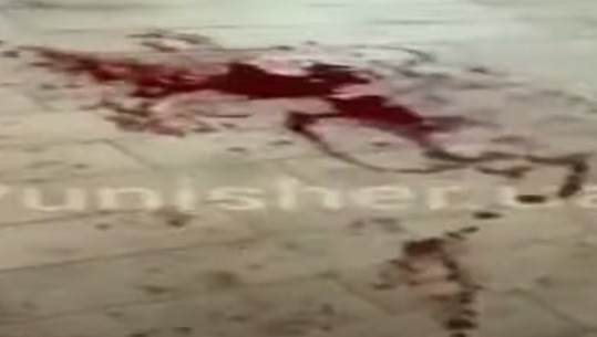 Gjak dhe trupa të lënduar, dalin pamjet disa minuta pas vrasjes së dy emigrantëve grekë nga ushtria ukrainase! Marrin mjekim të plagosurit (Video)