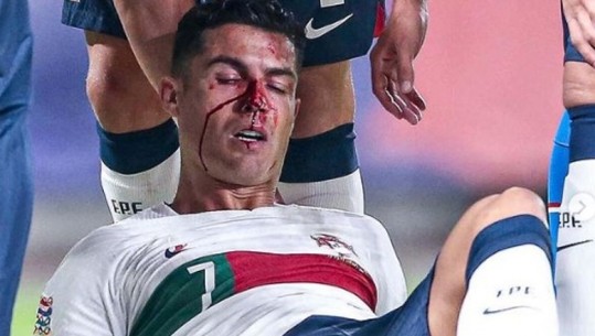 FOTO/ Ronaldo thyen hundën në ndeshjen me Çekinë, u përplas me portierin