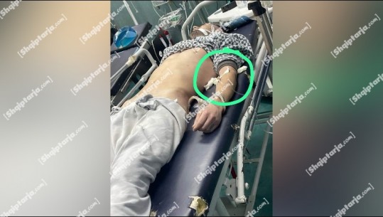 Spitali i Traumës tha se Lear Kurti mbërriti i vdekur, publikohet FOTO ku 32-vjeçari po merrte serum! Nën hetim mjekët