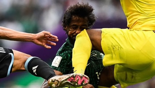 KATAR 2022/ Përplasje brutale në Argjentinë-Arabi Saudite, portieri ‘bën për spital’ shokun e skuadrës (VIDEO)