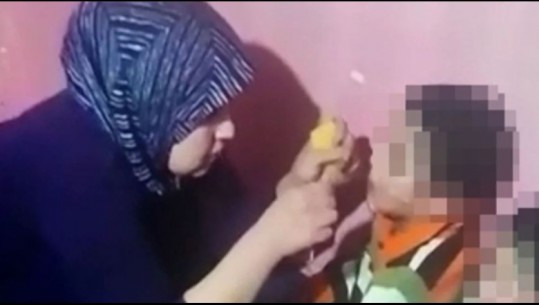 Dhunonin dhe digjnin me çakmak katër fëmijët e tyre, arrestohen prindërit në Turqi! Rasti i rëndë u zbulua nga fqinjët