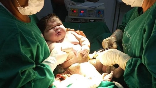 Vjen në jetë bebja ‘gjigante’ në Brazil, peshonte plot 7.3 kg