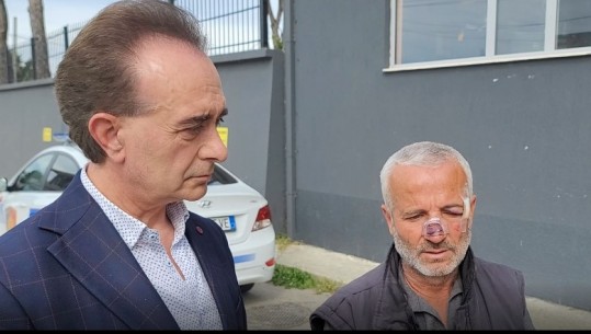 Luan Baçi denoncon: Punonjësi i bashkisë së Patosit është dhunuar pasi nuk pranoi të japë 10 emra si votues të sigurtë për PS-në