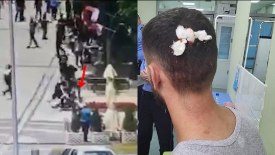 VIDEOLAJM/ Sveçla publikon pamjet, momenti kur dy shqiptarët rrihen brutalisht nga serbët në sheshin e Mitrovicës së Veriut
