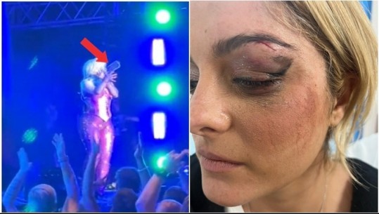 Goditi me telefon në fytyrë Bebe Rexhën gjatë koncertit, publikohen pamje nga arrestimi i autorit në mes të turmës