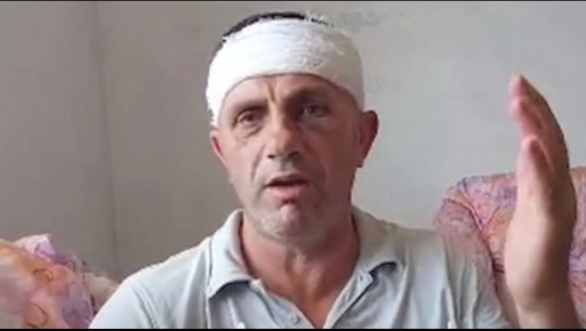 Sherri për guroren/ Flet i plagosuri në Borizanë: Më goditën me tyta armësh, i afërmi im është në gjendje shumë të keqe në spital