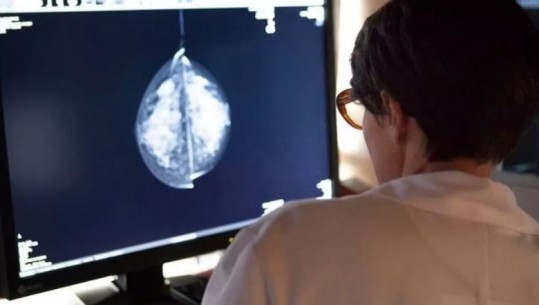 Studimi i ri: Inteligjenca artificiale ekzaminuesi më korrekt i kancerit të gjirit