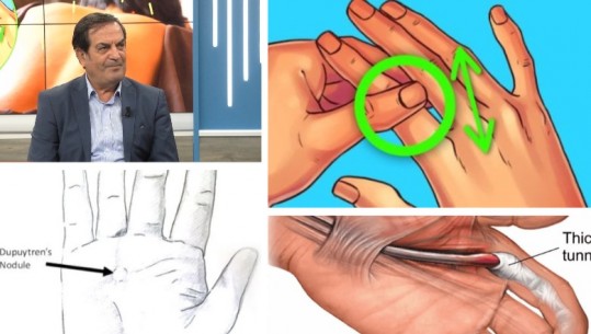 Shërimi përmes gishtave! Gishtat e dorës përgjegjëse për organet tona, ja harta e organeve që korrespondojnë