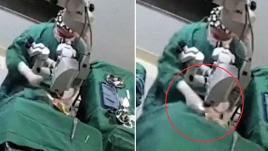 VIDEO/ Shokuese, pacientja lëviz gjatë operacionit, mjeku e godet me grusht në fytyrë