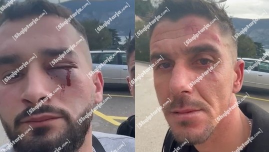 Pamje të rënda/ Me sy të ënjtur nga goditjet e plagë në trup, video e tre shqiptarëve të dhunuar në Mal të Zi