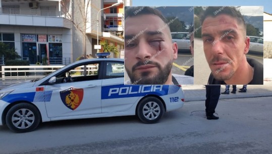 Policia shqiptare tregon si u dhunuan brutalisht tre të rinjtë në Mal të Zi: Po udhëtonin me makinë me targa gjermane, 7 persona i sulmuan pa asnjë shkak