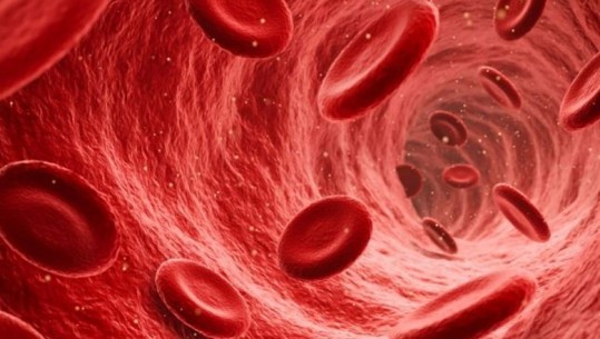 Shenjat dalluese të qarkullimit të dobët të gjakut në organizëm