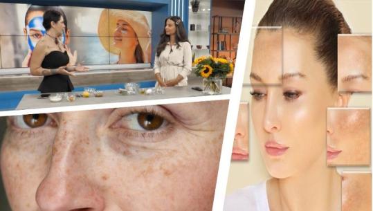 Rezultat që do ju habisë | Ke njolla kafe nga dielli? Provo këtë maskë bio me zero lekë që bën mrekulli