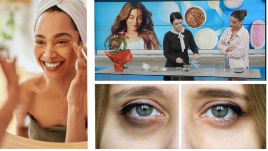  Thuaji lamtumirë rrathëve të errët me këtë maskë NATYRALE / Rezultati është WOW!