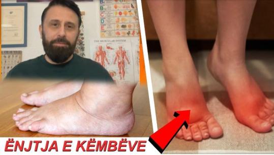 FRYRJA E KËMBËVE paralajmëron sëmundje serioze / Mos i INJORO këto shenja!