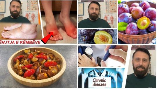 Emisioni i plotë ‘Rreze Dielli’, 22 Tetor 2025 – Receta/ Mit apo fakt/ Enjtja e këmbëve / Kumbullat, vlerat ushqyese 