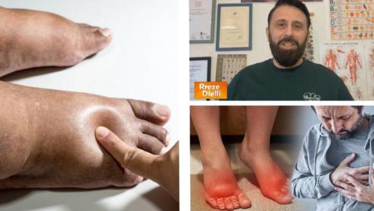 Gratë e neglizhojnë, por ënjtja e këmbëve fsheh disa probleme në trupin e tyre 