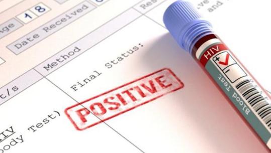 HIV-AIDS/ Shqipëria, ndër vendet e rajonit me incidencë të lartë, diagnostikimi në shumicën e rasteve është në fazë të vonuar