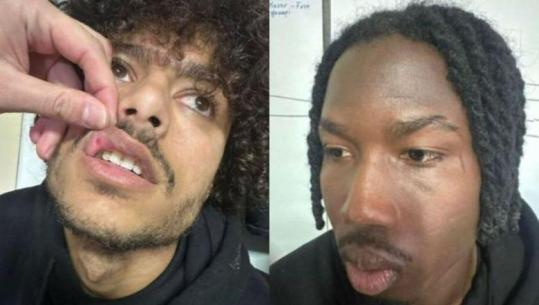 Dhunimi i futbollistëve dhe trajnerit Gjoka para ndeshjes, FSHF anulon Iliria - Skënderbeu! Korçarët: Kështu nuk luhet! Ekipi nga Fushë-Kruja: Shpifje