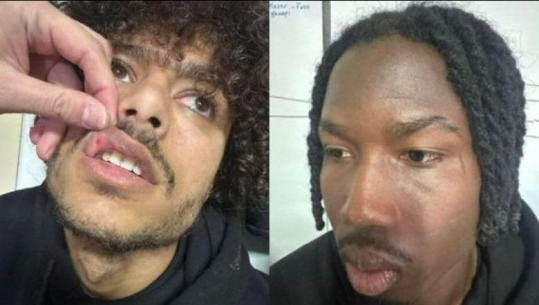 Dhunuan futbollistët e Skënderbeut, policia 'rrëzon' pretendimet e Ilirisë! Hetim në gjendje të lirë për dy sportistë dhe zyrtarin e klubit nga Fushë-Kruja