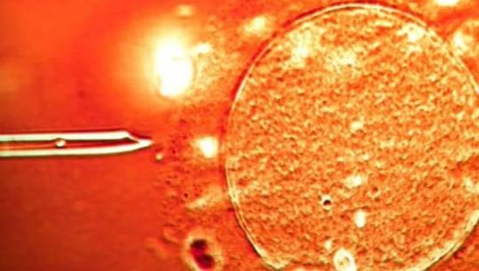 BBC: Në Shqipëri dhe 13 shtete të tjera u përdor sperma nga një dhurues me gjen që shkakton kancer