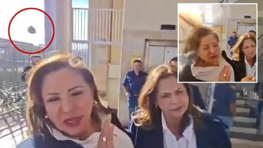 E rëndë në SHBA/ Po jepte deklaratë për mediat, deputetes i shpërthen eksplozivi në kokë