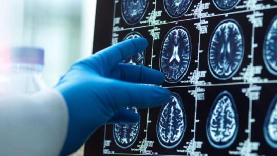 Pse gratë vuajnë më shumë nga demenca? Studiuesit ‘fajësojnë’ menopauzën