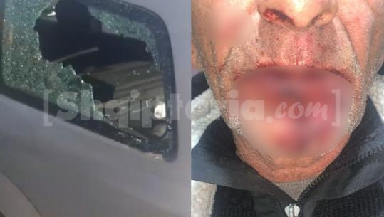 Durrës/ Dhunuan një çift brenda makinës së tyre, vihet nën hetim 44-vjeçari, shpallen në kërkim 2 të tjerë