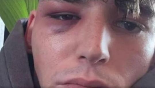 Propozoi të dashurin për martesë para 50 mijë tifozëve të Këlnit, dhunohet në shtëpi arbitri gjerman