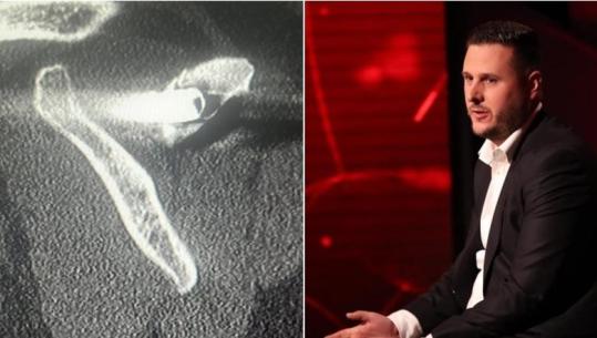 “Kam 27 vite me plumb në trup”- I mbijetuari i masakrës së Suharekës rrëfen tmerrin nga serbët: Na hodhën në kamionin me viktima, mbijetuam vetëm tre vetë