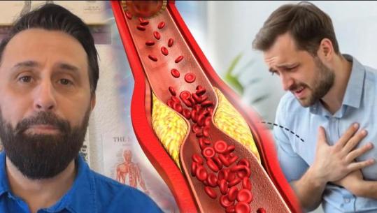 Kolesteroli, e VËRTETA që nuk ta kanë thënë / Këshilla nga Altin Joka