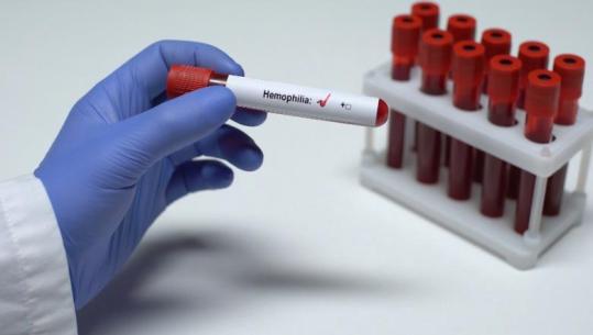 Dita ndërkombëtare e hemofilisë, mes mungesës së trajtimit dhe sfidave! Pacienti: 47 vite e sëmurë, vështirësi në trajtim dhe i pa punë