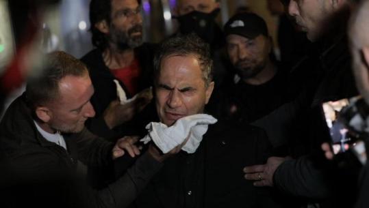 Protesta e Berishës, 4 të lënduar transportohen te ‘Trauma’! Mes tyre 1 efektiv policie, Luçiano Boçi dhe Kalaja