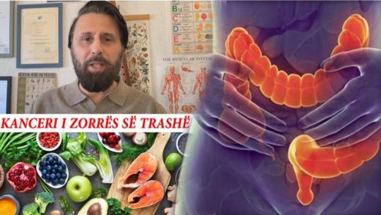 20-vjeçarë me kancer në zorrën e trashë, nutricionisti ngre shqetësimin: Dalloni këto shenja dhe mos hani këto produkte!