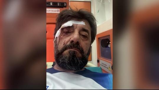 Dhunohet analisti Ilir Demalia, 2 persona e rrahën pranë shtëpisë! Njëri prej tyre shpallet në kërkim