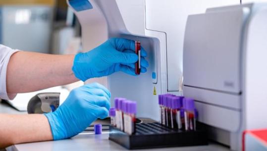 Qeveria përgatit rregulla të reja për tregun e pajisjeve diagnostikuese in vitro, në fokus siguria e pacientëve