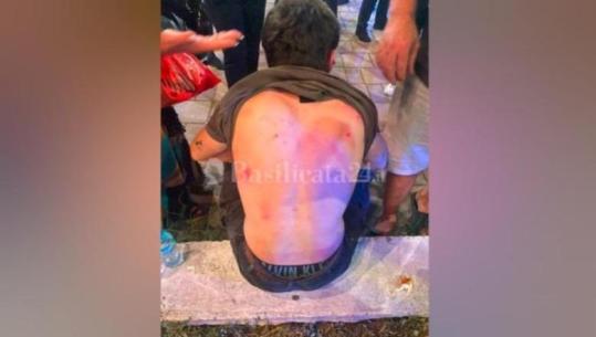 Tiranë/ Dyshsohet se dhunuan 20-vjeçarin italian që kishte ardhur për pushime, shoqërohen dhe vihen nën hetim 8 të mitur, të moshës 13-15 vjeç