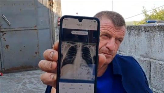 Me brinjë të dëmtuara e ilaçe në xhep, zjarrfikësi në Krujë s’e braktis detyrën: Do ta bëjmë me zemër