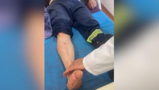 Në luftë me flakët dhe me shëndetin/ Guri shkëputet nga mali dhe lëndon zjarrfikësin në Krujë
