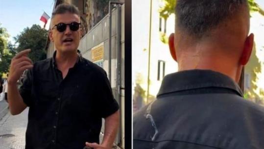 Ylli Pata: Kush fiton nga agresiviteti toksik i flamingove?