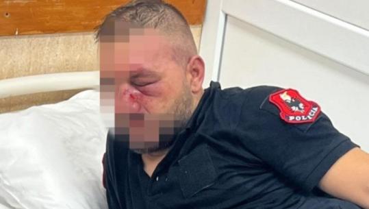 14 efektivë të lënduar nga protesta, Policia e Shtetit thirrje protestuesve: Distancohuni menjëherë nga dhuna