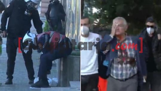 Lëndohen një protestues e një polic! Disa të shoqëruar, ende asnjë prej të maskuarve