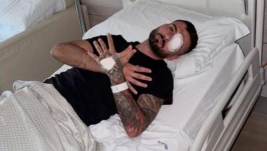 U plagos në sy në protestë, Erjon Vishkulli reagon pas ndërhyrjeve kirurgjikale: Falënderoj shqiptarët për mbështetjen dhe Zotin për forcën!