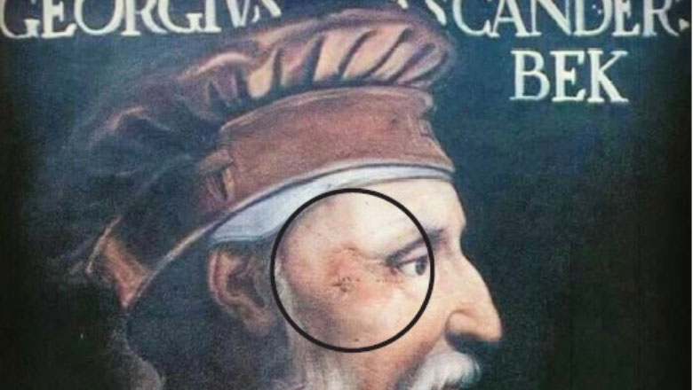 Plaga në syrin e djathtë zbulon portretin origjinal të Skënderbeut