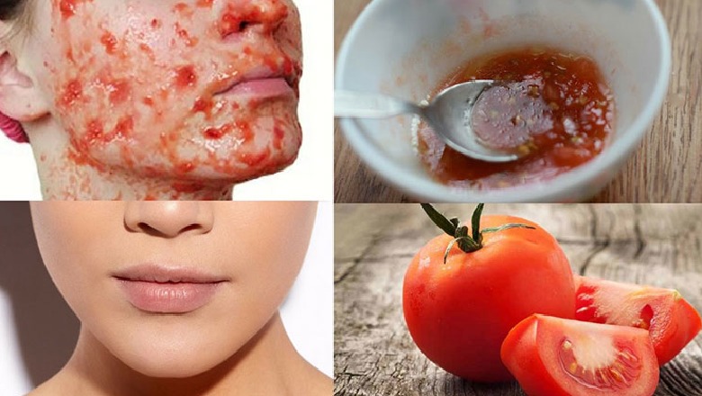 Maskë fytyre me bazë domate, zbuloni efektin mahnitës që bën në lëkurën tuaj