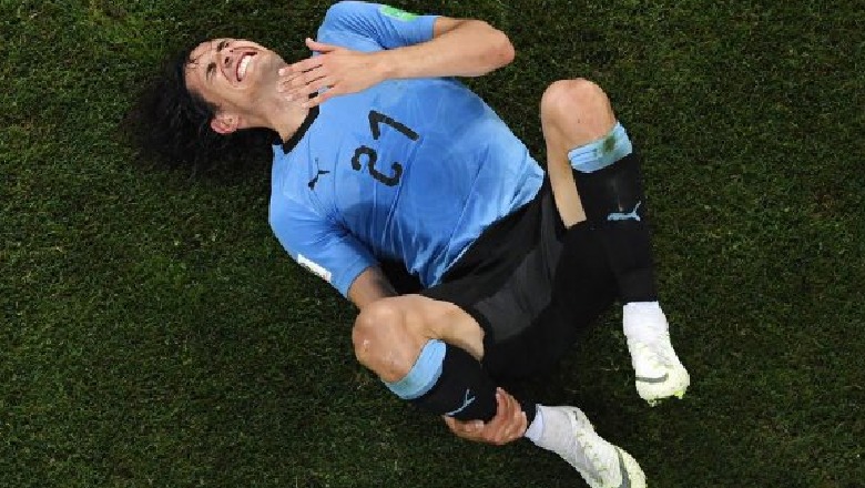 Dëmtimi i Kavanit pas ndeshjes me Portugalinë frikëson Uruguain