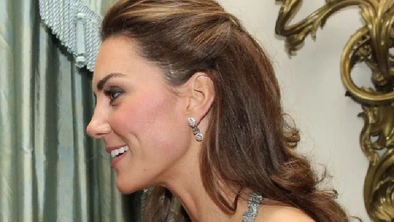 Historia e shenjës 7.5 cm që Kate Middleton ka shumë pranë fytyrës