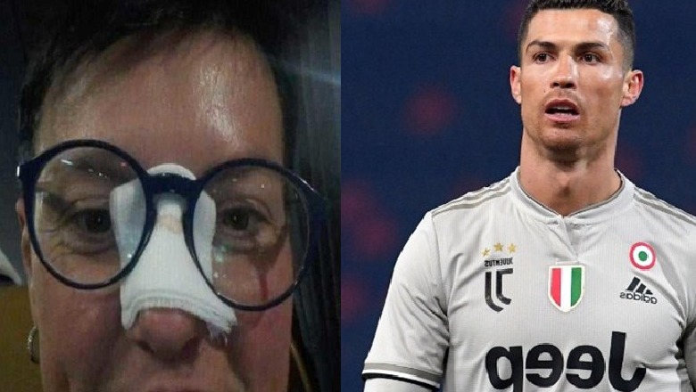 E goditi me top në fytyrë, 46-vjeçarja i bën kërkesën e pazakontë Cristiano Ronaldos